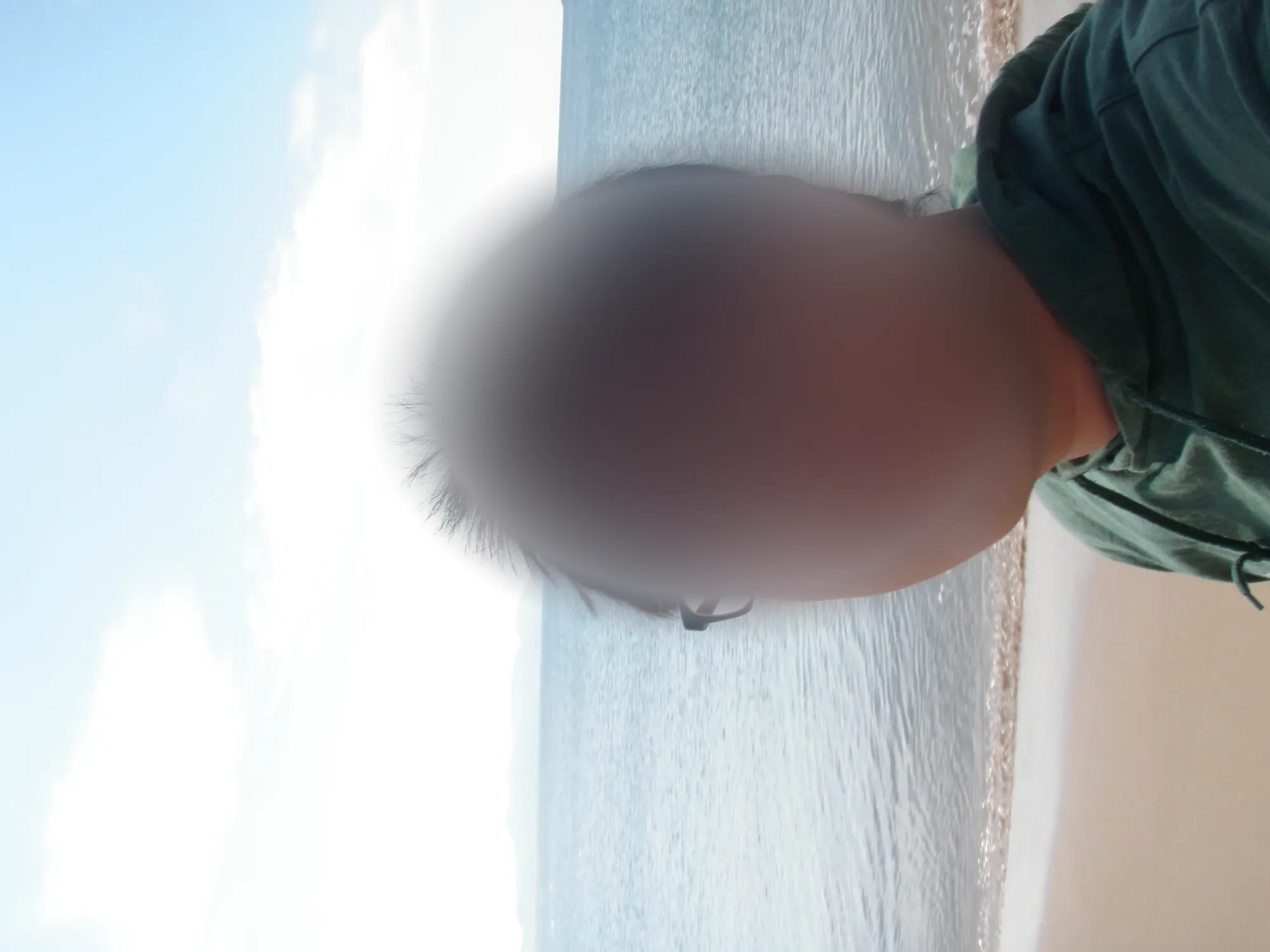 옆으로 누운 사진에서 초록색 옷을 입은 안경 쓴 남자의 머리가 오른쪽 위에 크게 걸린 모습, 얼굴은 흐림 처리